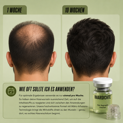Haardichte Infuse