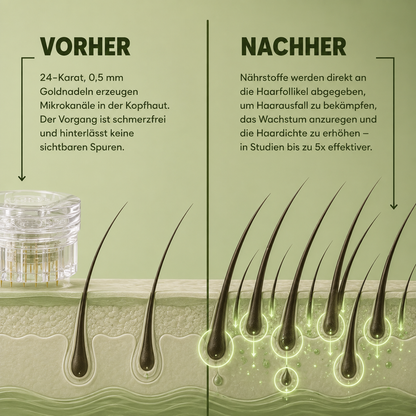 Haardichte Infuse