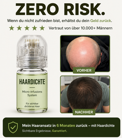 Haardichte Infuse